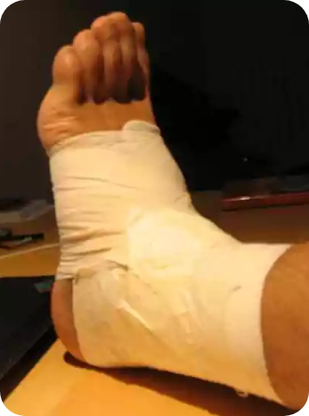 Torci meu tornozelo! Preciso procurar o hospital?
