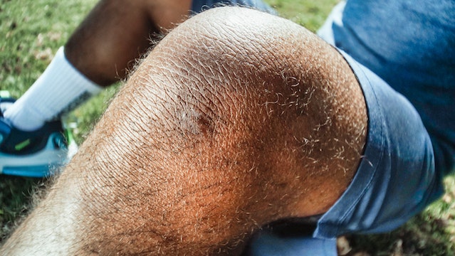 Ligamentos do joelho: o que fazer ao romper?