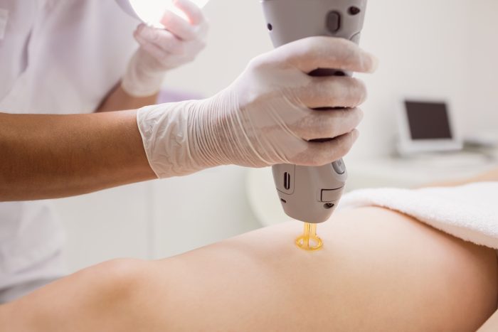 Laserterapia fisioterapia: o que é e para que serve
