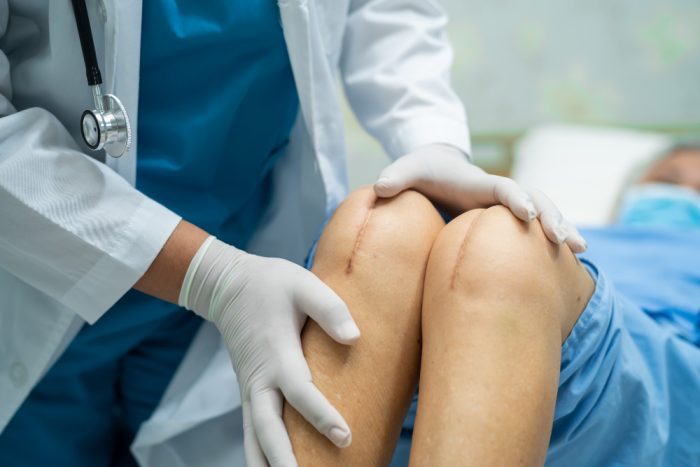 Cirurgia de LCA: cirurgia de ligamento do joelho